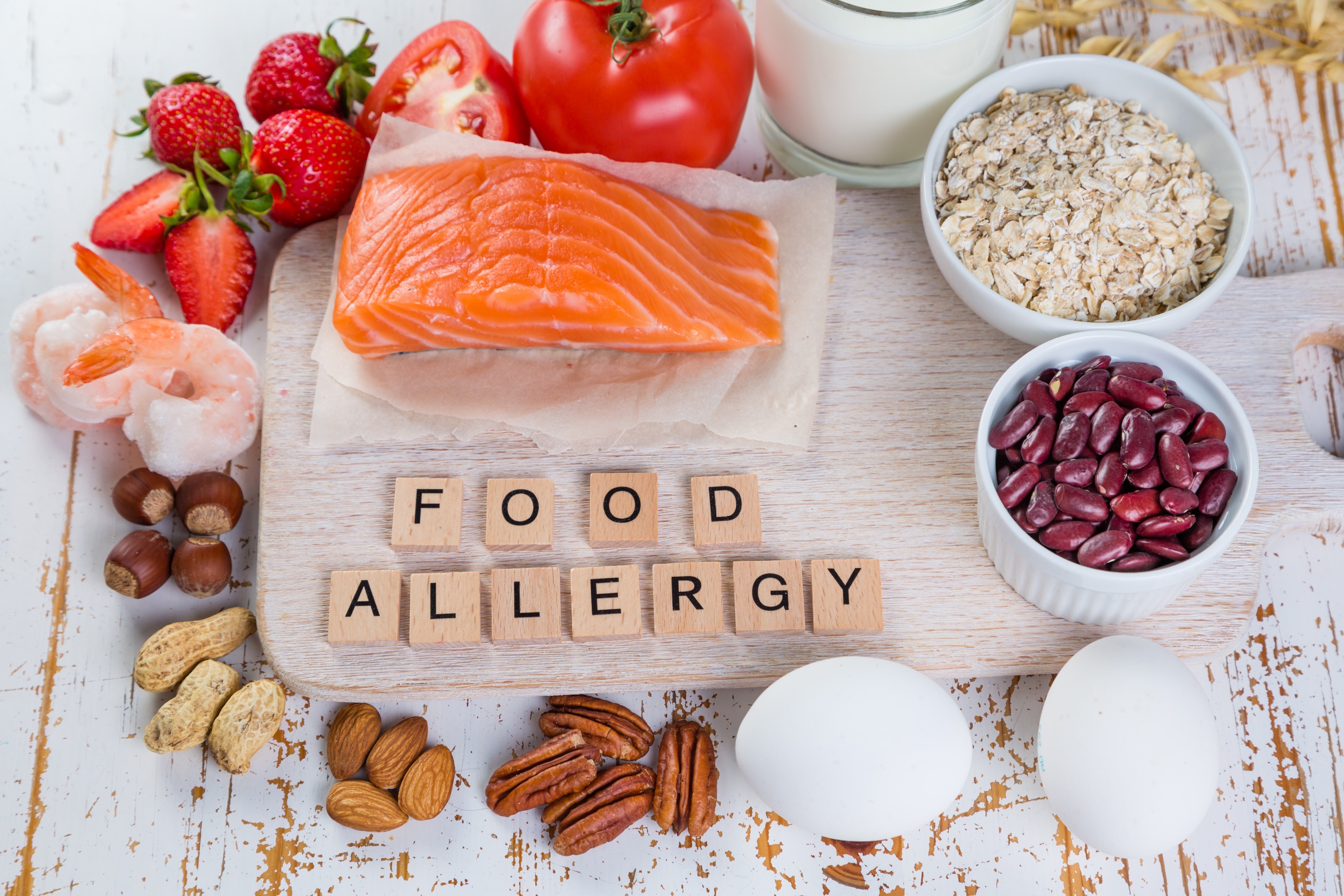 Food allergies – food concept with major allergens